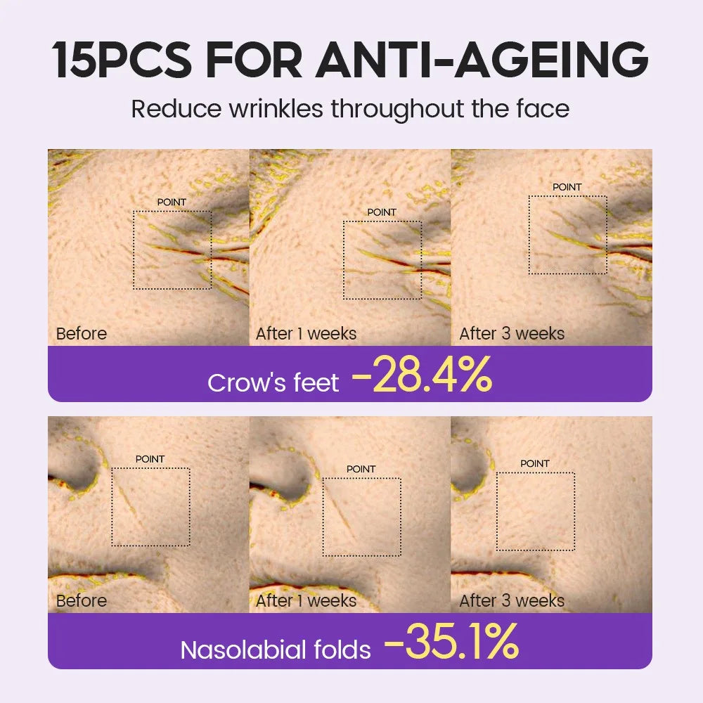 Retinol + Pro-xylane Ampullserum Lugnar, Reparerar, Stärker huden och Minskar fina linjer